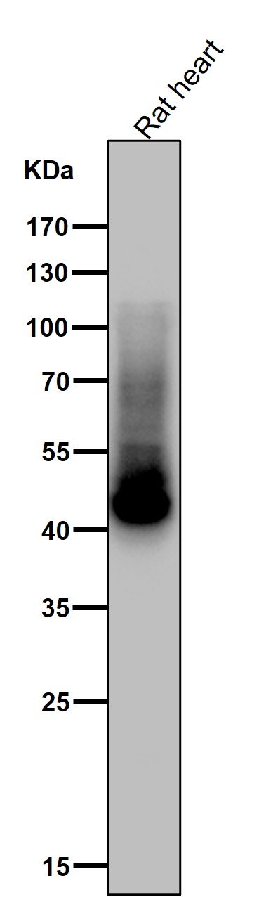 1 - Anti-Phospho-GLUT4 (S488) Rabbit Monoclonal Antibody ABO16763