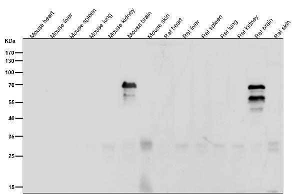1 - Anti-Phospho-VAV1 (Y174) Rabbit Monoclonal Antibody ABO16764