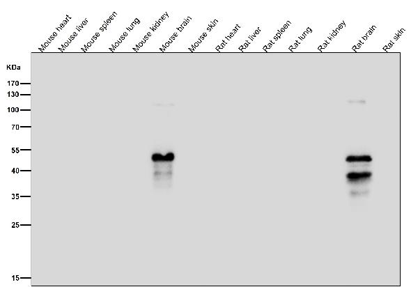 1 - Anti-Phospho-MAP2 (S136) Rabbit Monoclonal Antibody ABO16766