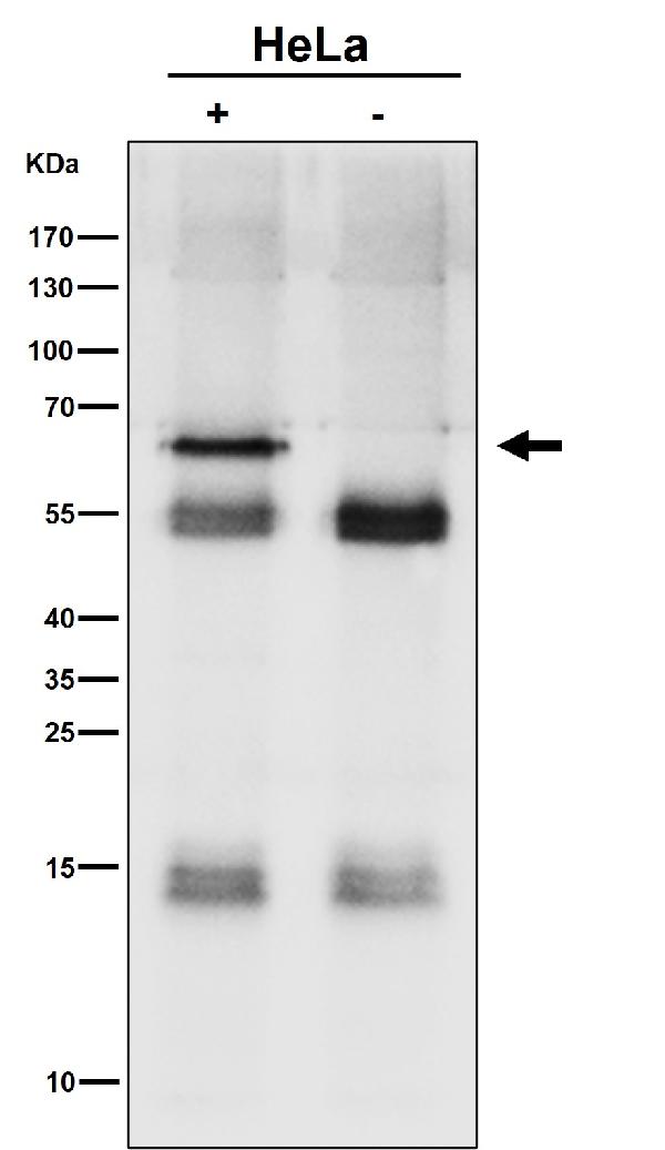 1 - Anti-SYVN1 / HRD1 Rabbit Monoclonal Antibody ABO16767