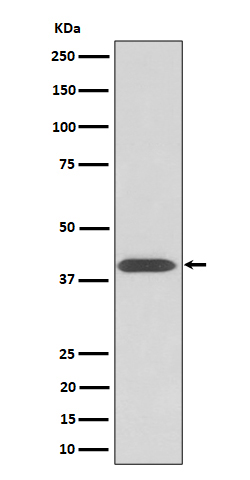 1 - Anti-Phospho-PKA C (Thr197) Rabbit Monoclonal Antibody ABO16770