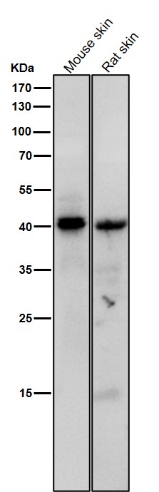 1 - Anti-Phospho-PKA C (Thr197) Rabbit Monoclonal Antibody ABO16770