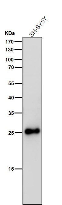1 - Anti-SNAP25 Rabbit Monoclonal Antibody ABO16771