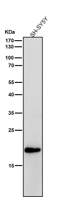 1 - Anti-C Reactive Protein Rabbit Monoclonal Antibody ABO16773