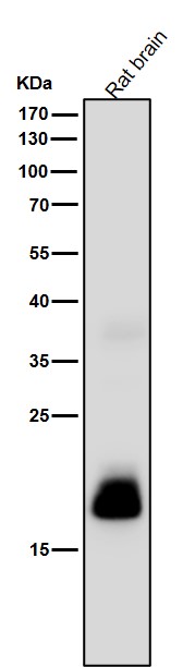 1 - Anti-C Reactive Protein Rabbit Monoclonal Antibody ABO16773