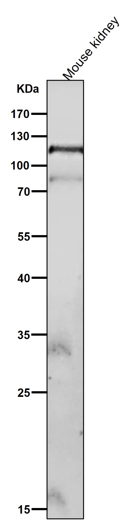 1 - Anti-Phospho-FAK (Y576 + Y577) Rabbit Monoclonal Antibody ABO16775