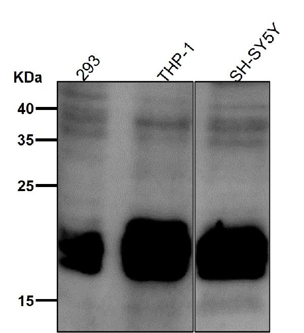 1 - Anti-Phospho-eIF4EBP1 (T70) Rabbit Monoclonal Antibody ABO16777