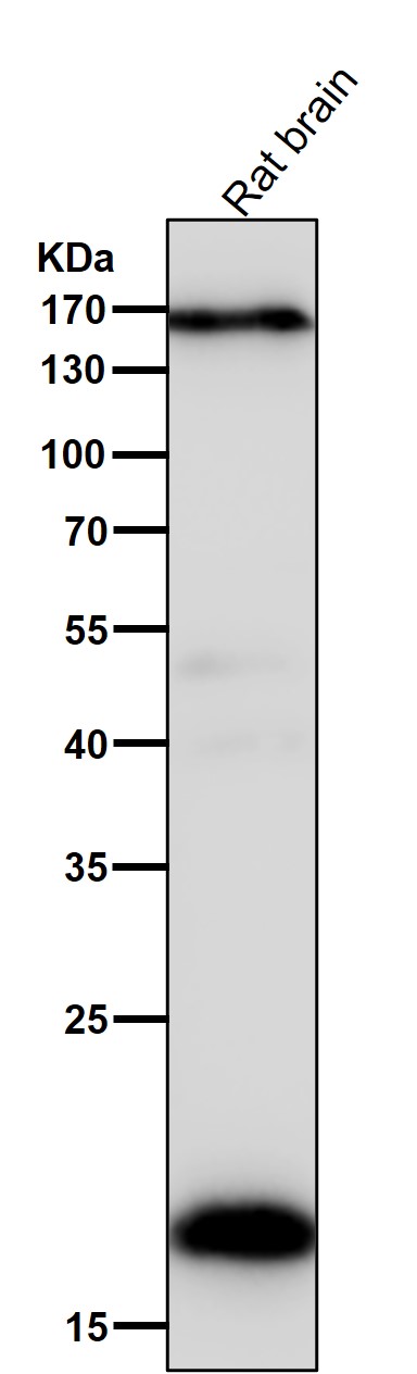 1 - Anti-Pleiotrophin Rabbit Monoclonal Antibody ABO16783