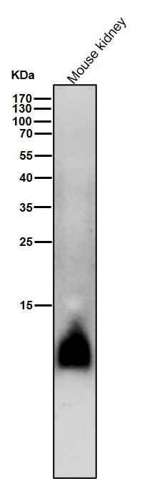 1 - Anti-Phospho-Phospholamban (S16) Rabbit Monoclonal Antibody ABO16784