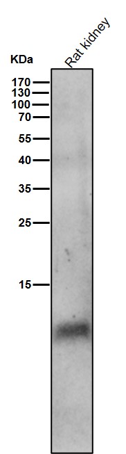 1 - Anti-Phospho-Phospholamban (S16) Rabbit Monoclonal Antibody ABO16784
