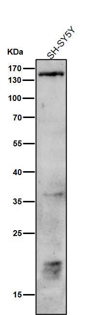1 - Anti-Phospho-PLCB3 (S537) Rabbit Monoclonal Antibody ABO16786