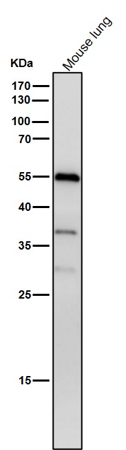 1 - Anti-Phospho-beta Arrestin 1 (S412) Rabbit Monoclonal Antibody ABO16789