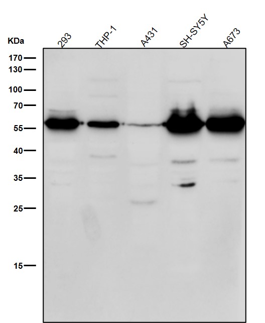 1 - Anti-Phospho-beta Arrestin 1 (S412) Rabbit Monoclonal Antibody ABO16789