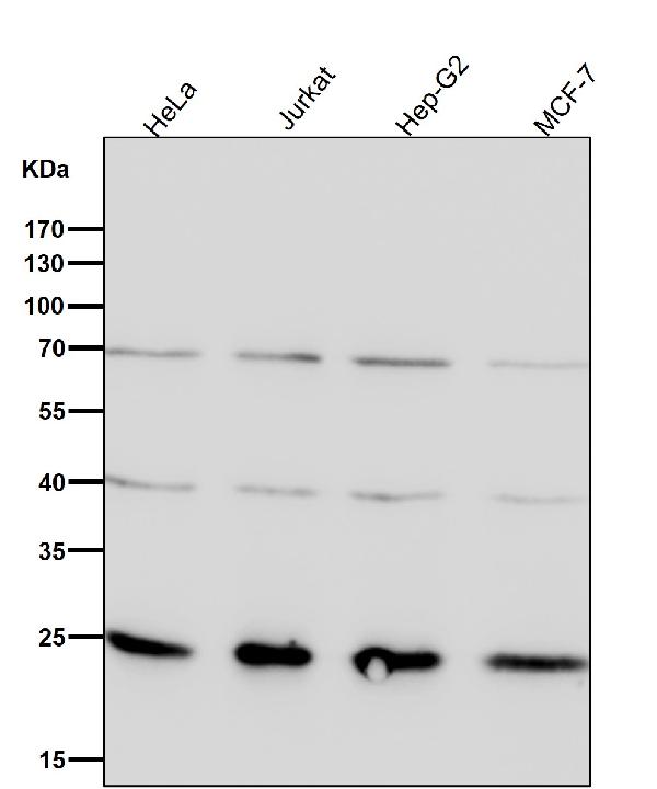 1 - Anti-GRB2 Rabbit Monoclonal Antibody ABO16790