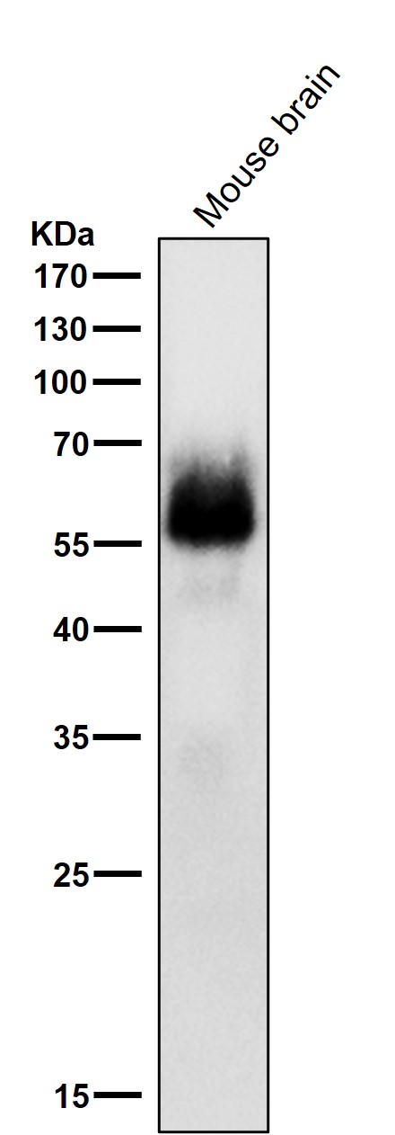 1 - Anti-Phospho-Chk2 (S33 + S35) Rabbit Monoclonal Antibody ABO16795