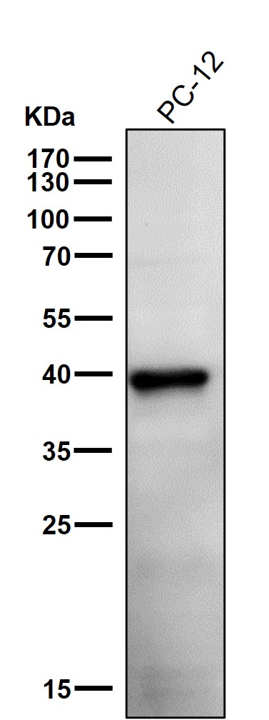 1 - Anti-Phospho-PRAS40 (T246) Rabbit Monoclonal Antibody ABO16797