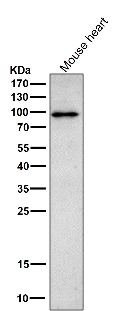 1 - Anti-Phospho-beta Catenin (T41 + S45) Rabbit Monoclonal Antibody ABO16798