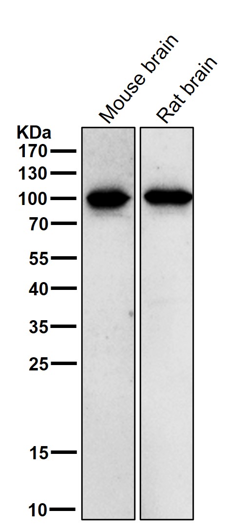 1 - Anti-Phospho-beta Catenin (T41 + S45) Rabbit Monoclonal Antibody ABO16798