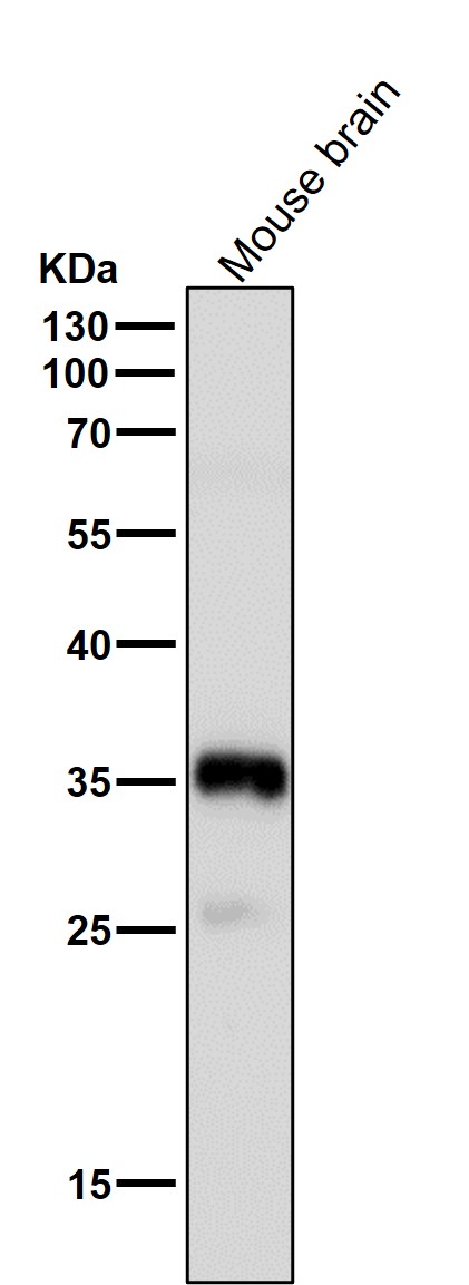 1 - Anti-Phospho-Nucleophosmin (S125) Rabbit Monoclonal Antibody ABO16800