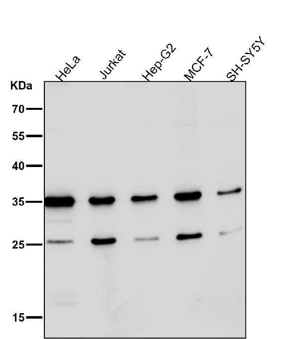 1 - Anti-Phospho-Nucleophosmin (S125) Rabbit Monoclonal Antibody ABO16800