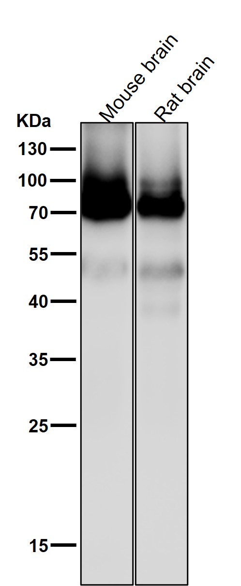 1 - Anti-PKC Rabbit Monoclonal Antibody ABO16805
