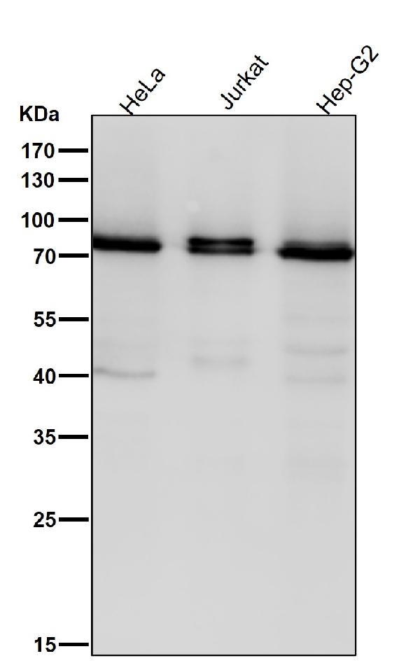 1 - Anti-PKC Rabbit Monoclonal Antibody ABO16805