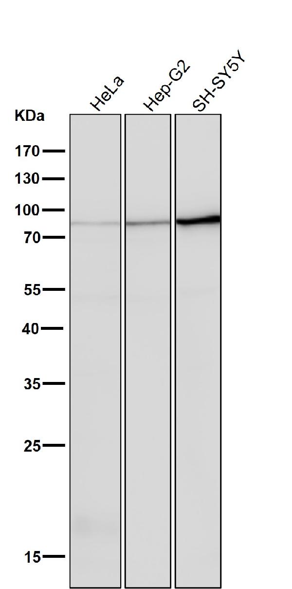 1 - Anti-PKC Rabbit Monoclonal Antibody ABO16806