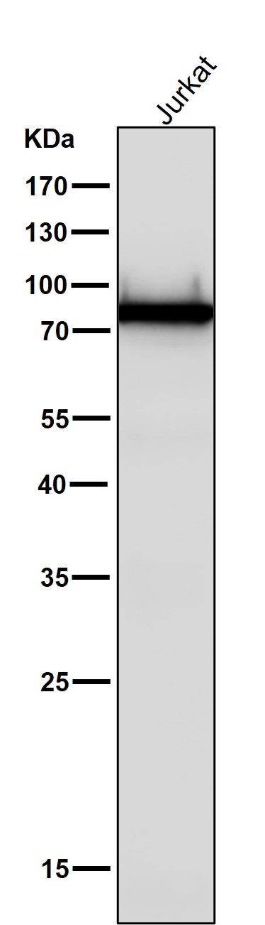 1 - Anti-PKC Rabbit Monoclonal Antibody ABO16806
