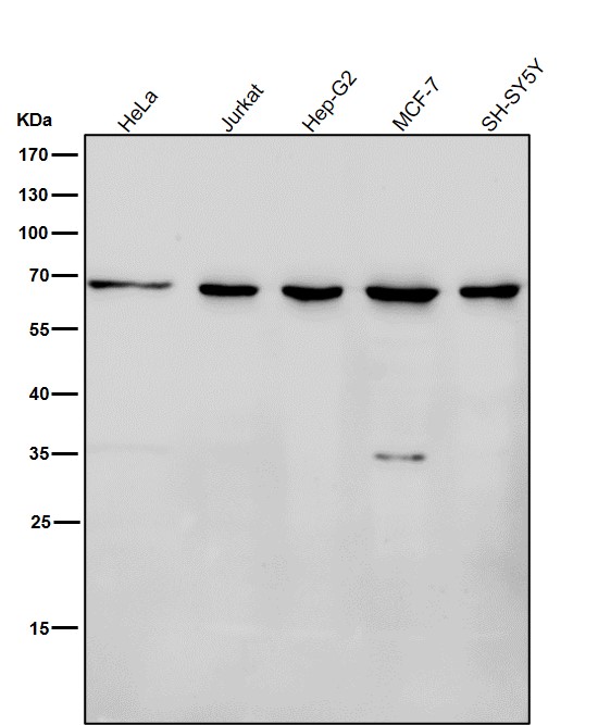1 - Anti-NELFB Rabbit Monoclonal Antibody ABO16809