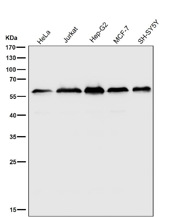1 - Anti-KLC3 Rabbit Monoclonal Antibody ABO16812