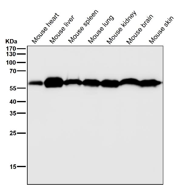 1 - Anti-KLC3 Rabbit Monoclonal Antibody ABO16812