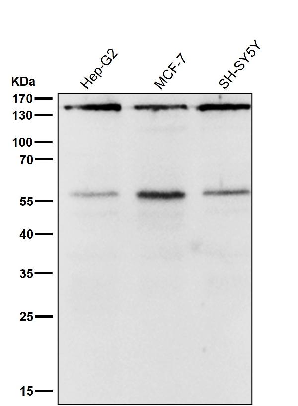 1 - Anti-ROCK1 Rabbit Monoclonal Antibody ABO16813