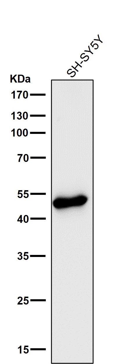 1 - Anti-DCAF13 Rabbit Monoclonal Antibody ABO16814