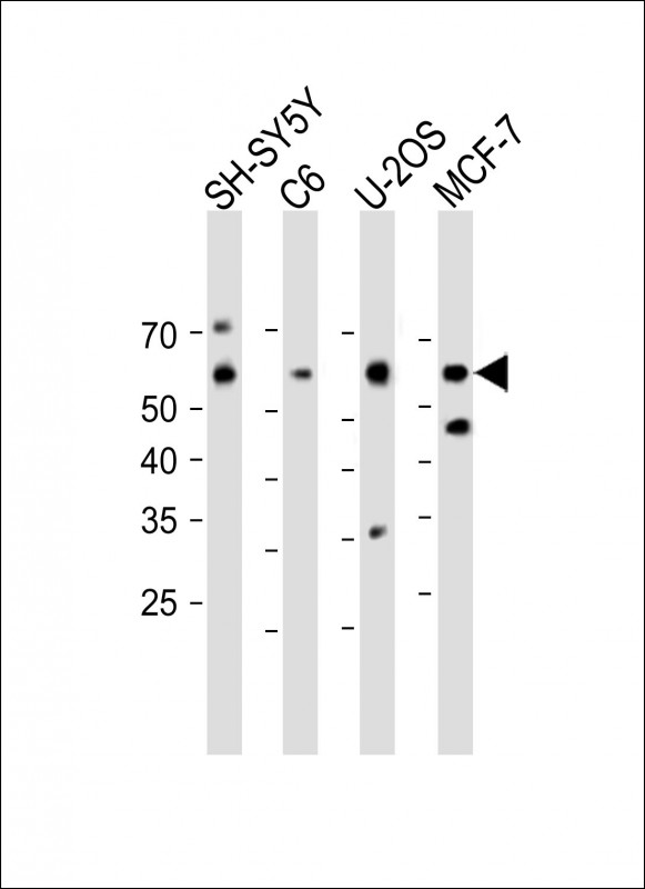 1 - E2F1(S332) Antibody AP22491a