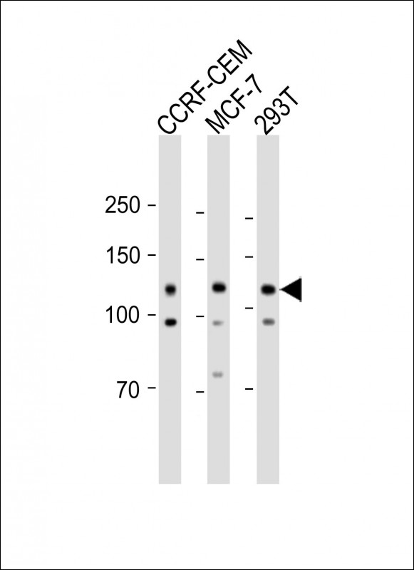 1 - ANKFY1 Antibody (C-term) AP4704b