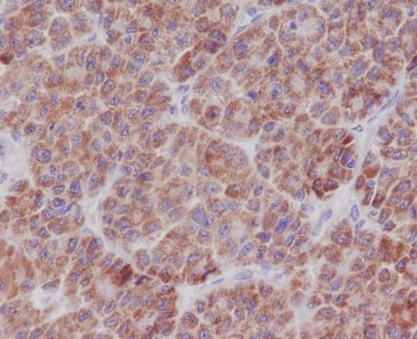 2 - TNFAIP3 Antibody AP90763