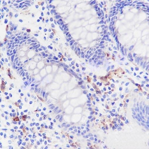 14 - Sialoadhesin/CD169 Rabbit mAb AP96154