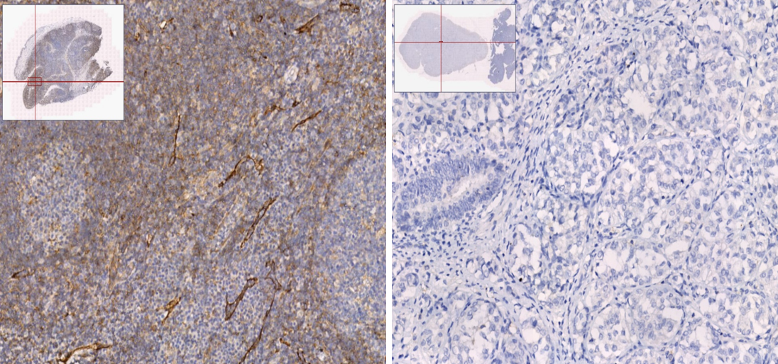 14 - Recombinant Anti-LKB1 Rabbit mAb AP96155