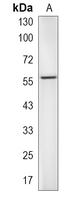 1 - Recombinant Anti-LKB1 Rabbit mAb AP96155