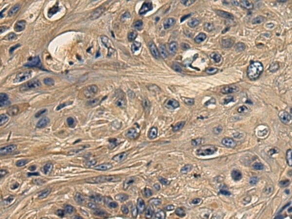 2 - DNAJB11 Rabbit pAb AP96158