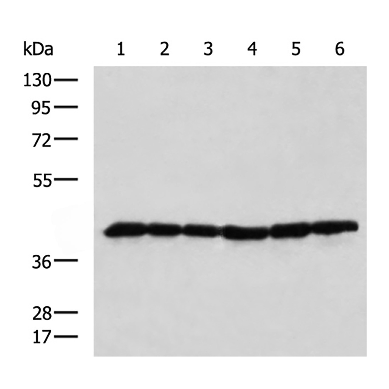 1 - DNAJB11 Rabbit pAb AP96158