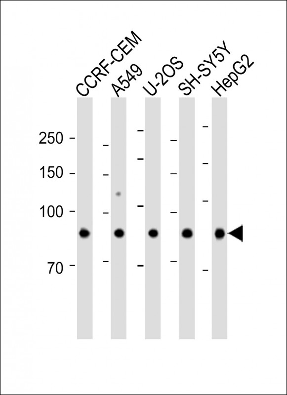 1 - FAM22E Antibody (C-term) AP12000b