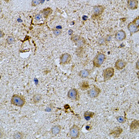 2 - Anti-NAT8 Antibody AP96156