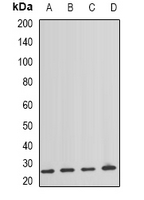 1 - Anti-NAT8 Antibody AP96156
