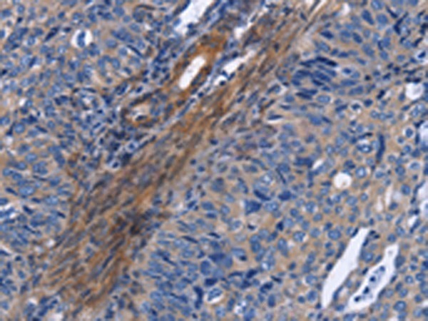 14 - NAT8 Rabbit pAb AP96157