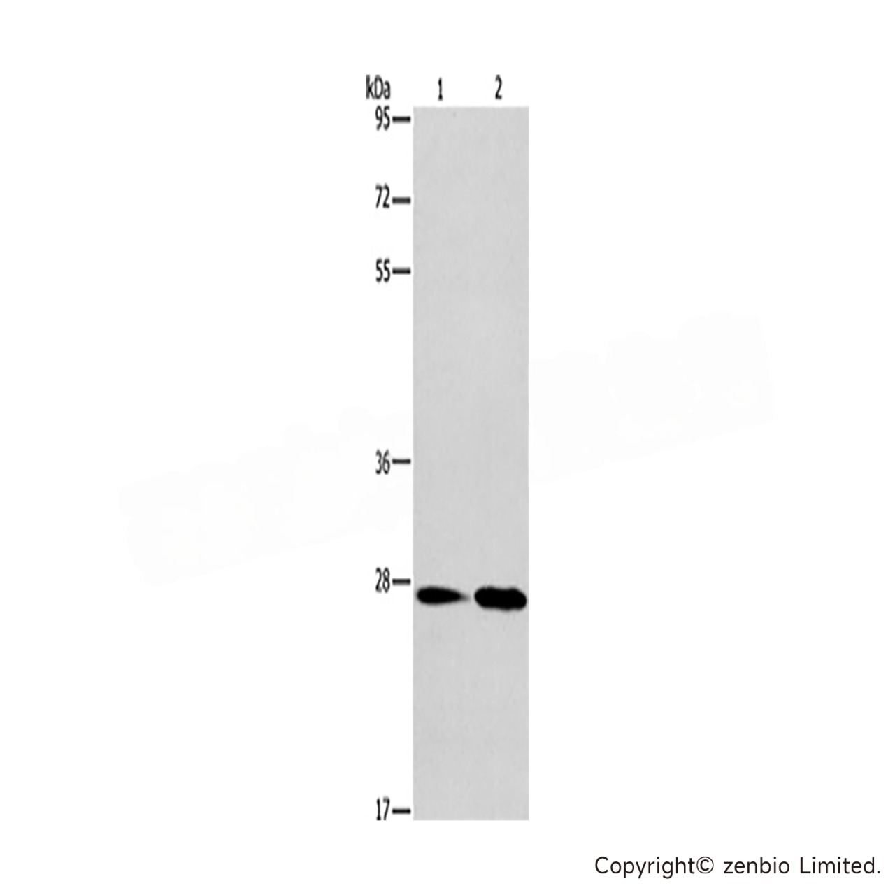 1 - NAT8 Rabbit pAb AP96157