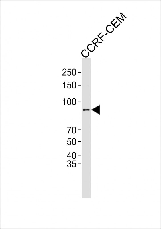 1 - NUTM2E Antibody (C-term) AP22493b