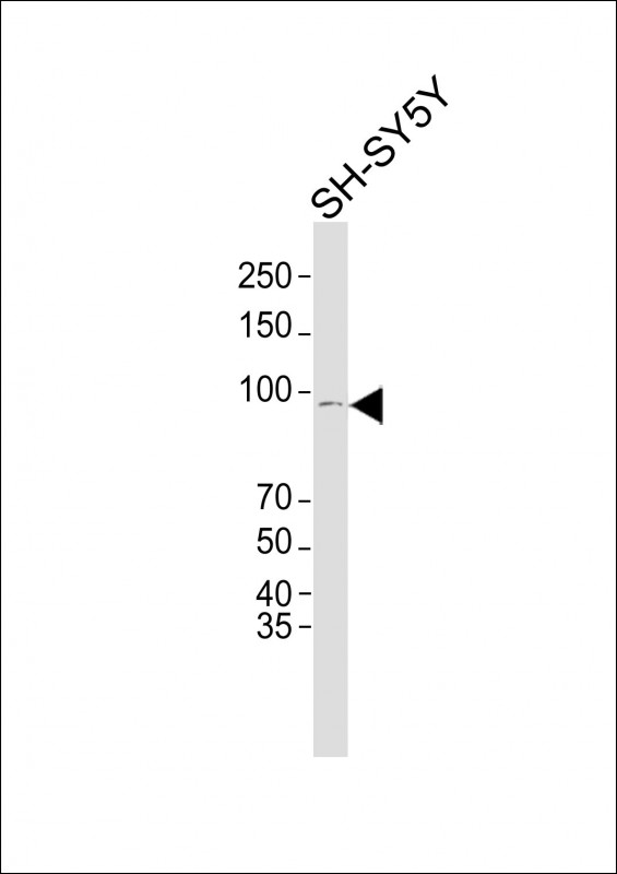 1 - NUTM2E Antibody (C-term) AP22494b