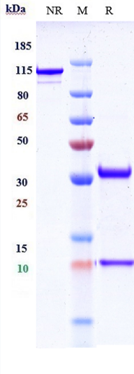 0 - Anti-PCSK9 Reference Antibody (lodelcizumab) APR10471