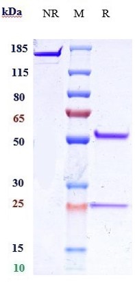 0 - Anti-IL-25 Reference Antibody (Centocor patent anti-IL-25) APR10955